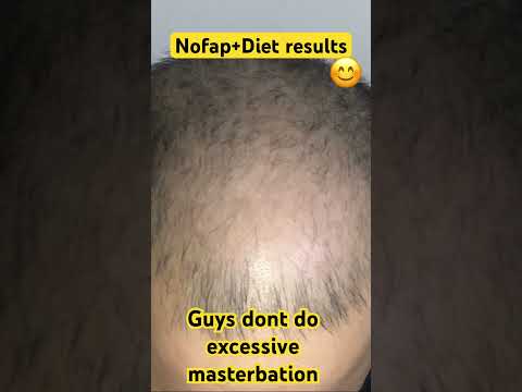 Image YouTube