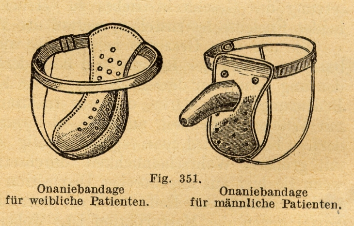 Repr&eacute;sentation de deux mod&egrave;les (f&eacute;minin &agrave; gauche, masculin &agrave; droite) de ceintures de chastet&eacute;, pour emp&ecirc;cher la masturbation, dans le livre Handbuch der Sexualwissenschaften (&laquo;Manuel des sciences sexuelles&raquo;) du psychiatre et sexologue allemand Albert Moll, paru en 1921. | Domaine public / via Wikimedia Commons